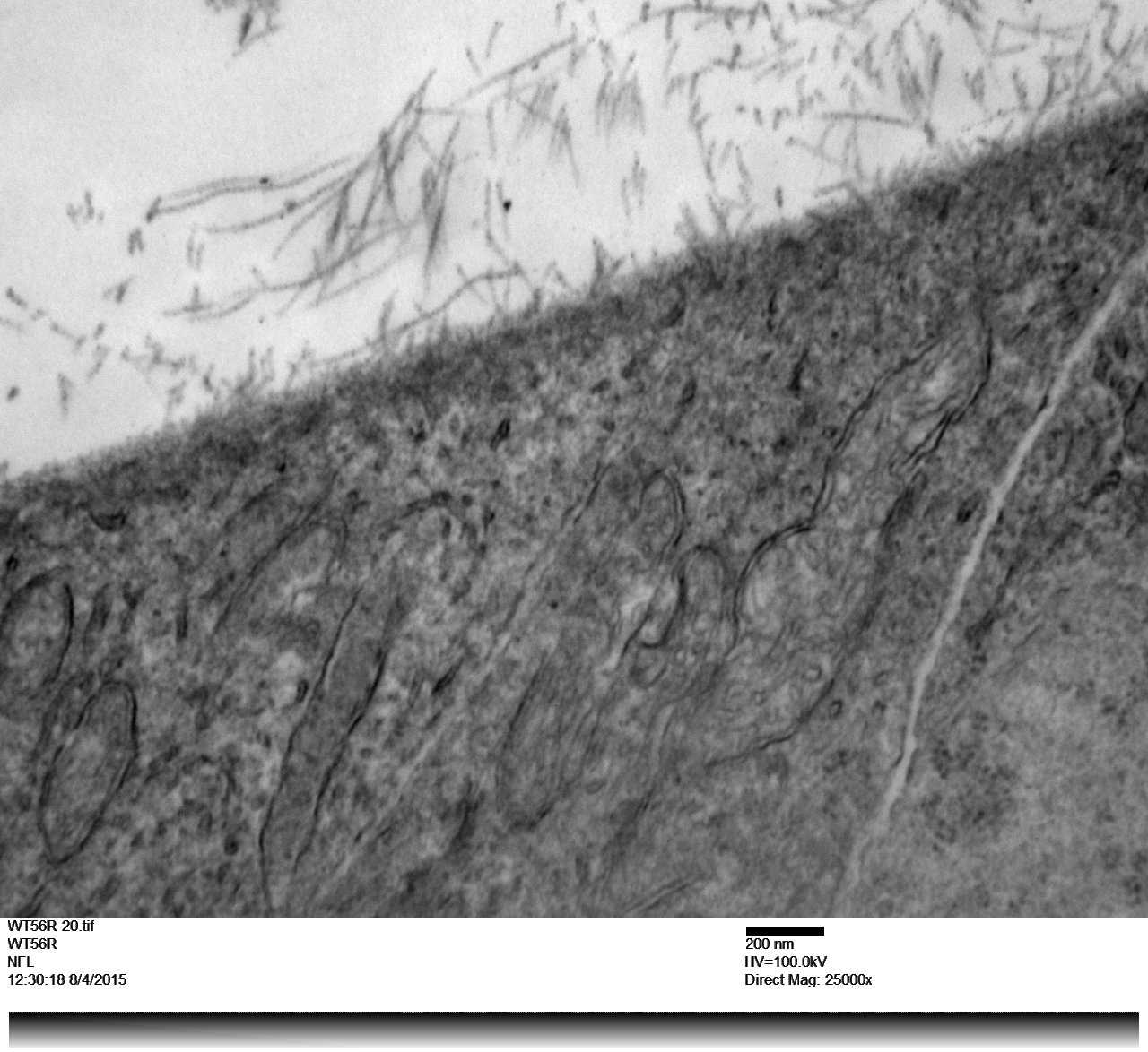 Mouse retina inner limiting membrane showing fibers from the vitrious humor