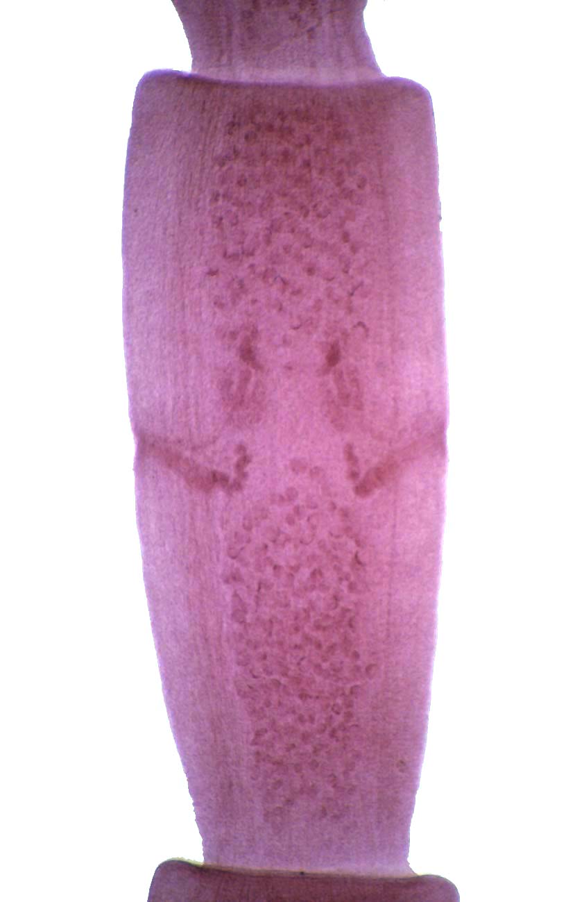 Dipylidium Caninum