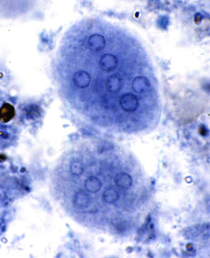 Entamoeba Nana
