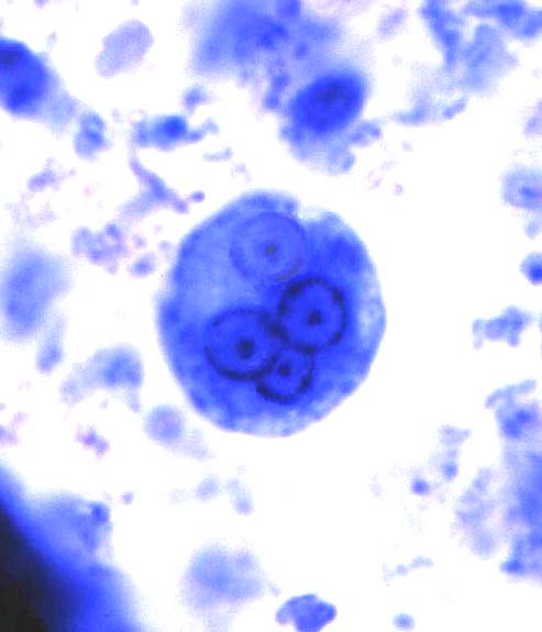 endolimax nana cysts