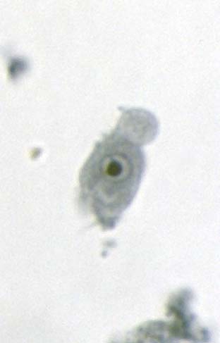 endolimax nana cysts