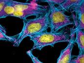 HeLa Cells