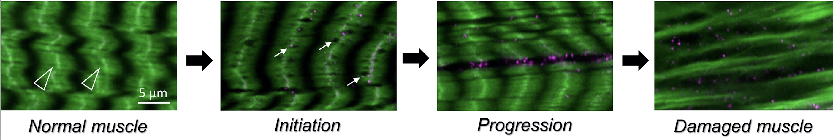 proteinaggregation