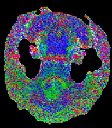 brain image