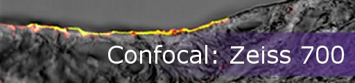 Confocal: Zeiss 700