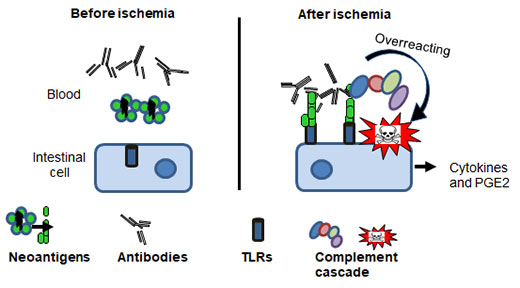 ischemia-repefusion