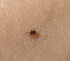 are dog ticks bad for humans