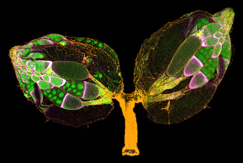 Pair of ovaries filled with egg precursors (“egg chambers”) from an adult fruit fly.