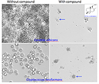 Antifungal resistant clinical Candida albicans and Cryptococcus