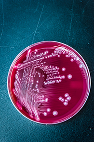 Fusobacterium necrophorum