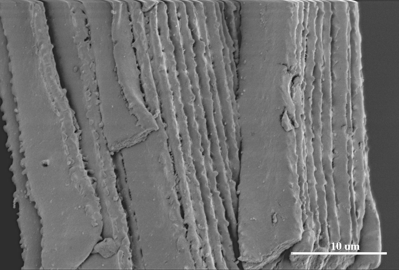 Lens fiber cells