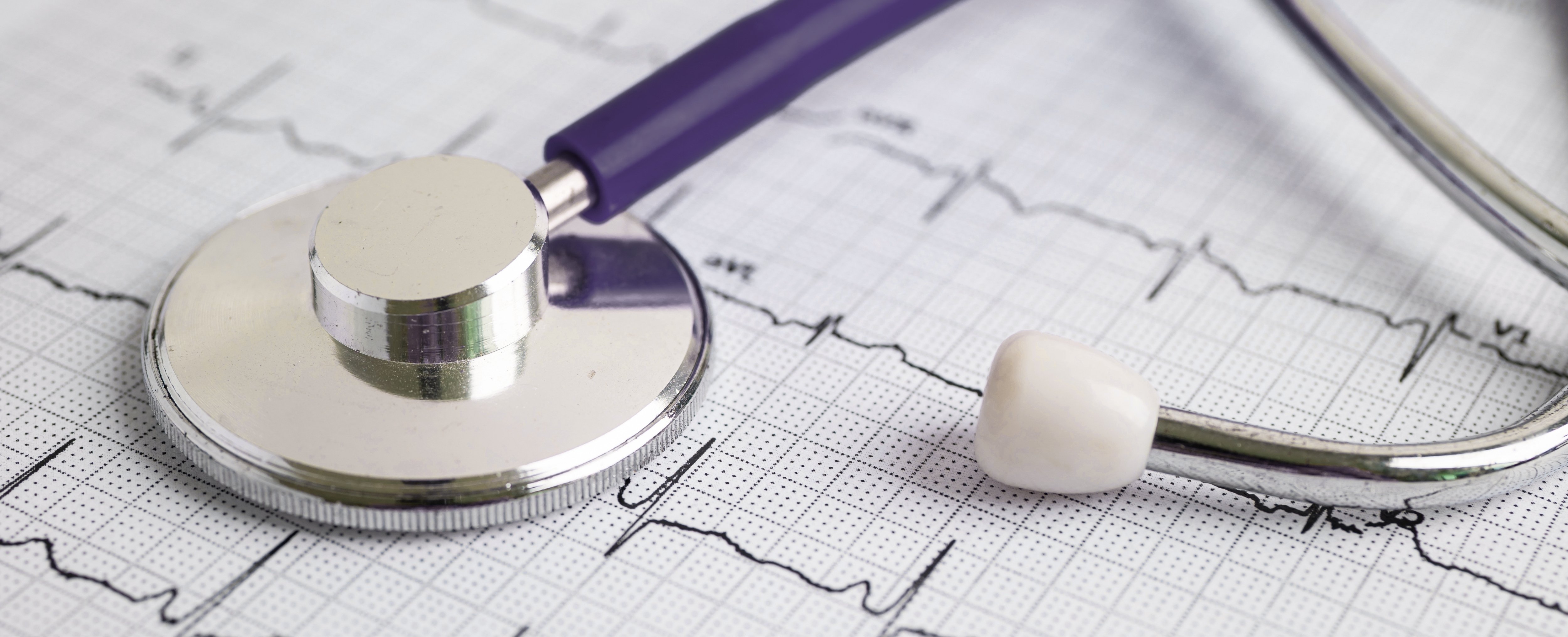 A close-up image of a purple stethoscope, laying on a printed cardiogram.