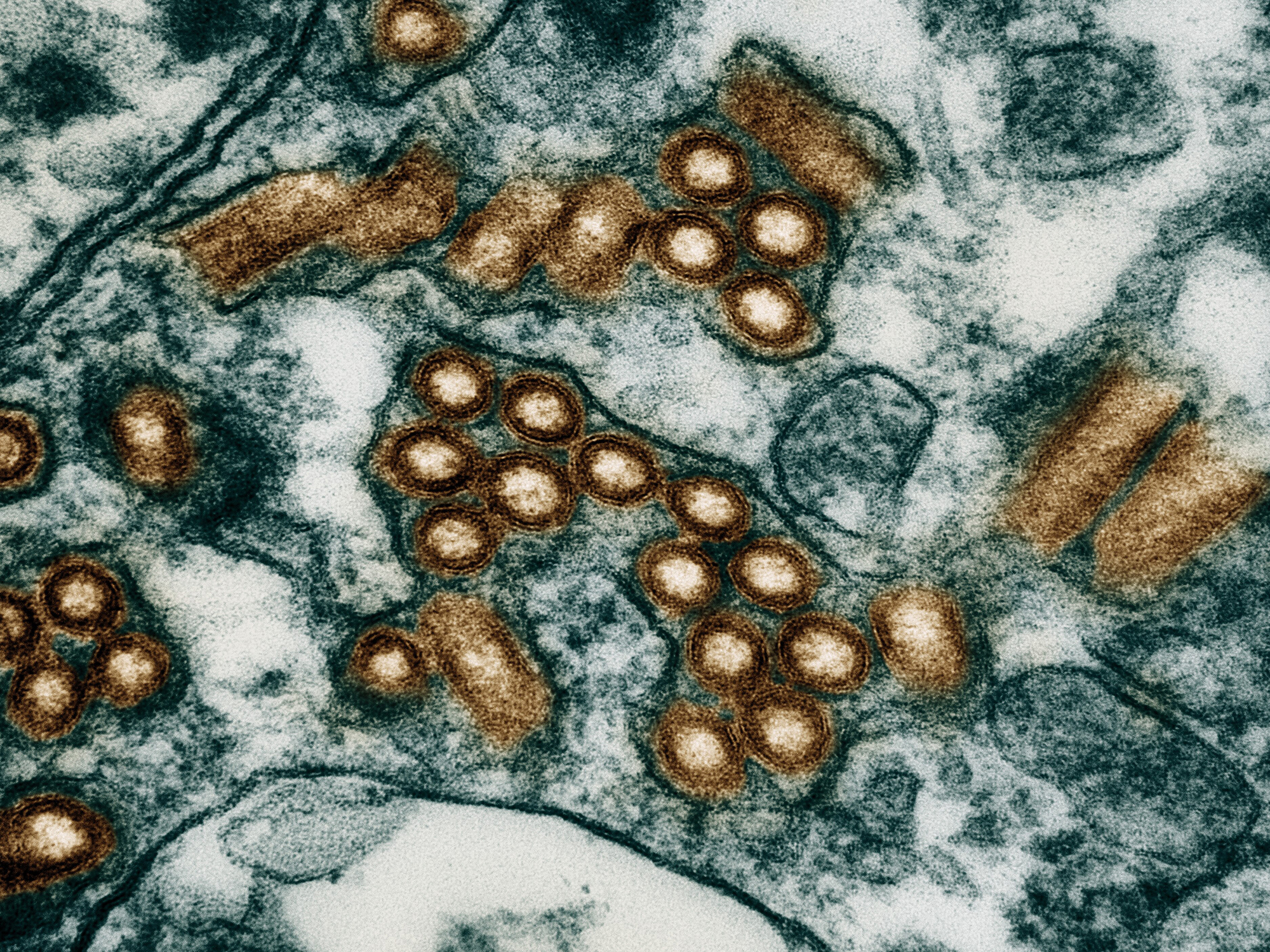 A scanning electron microscope image of rabies particles show them as gold blobs against a greenish background.
