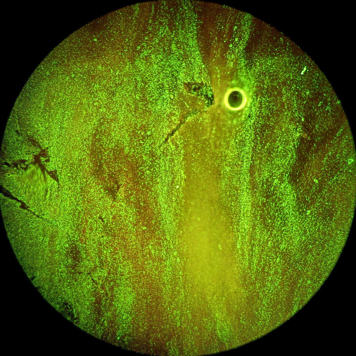 A microscopic slide shows a positive sample of rabies as a bright green blob.