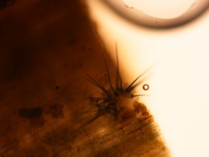 anthracnose-setae-microscope