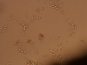 black-spot-spores-2