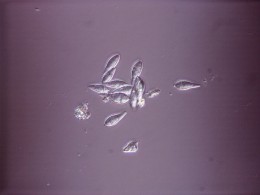 spores