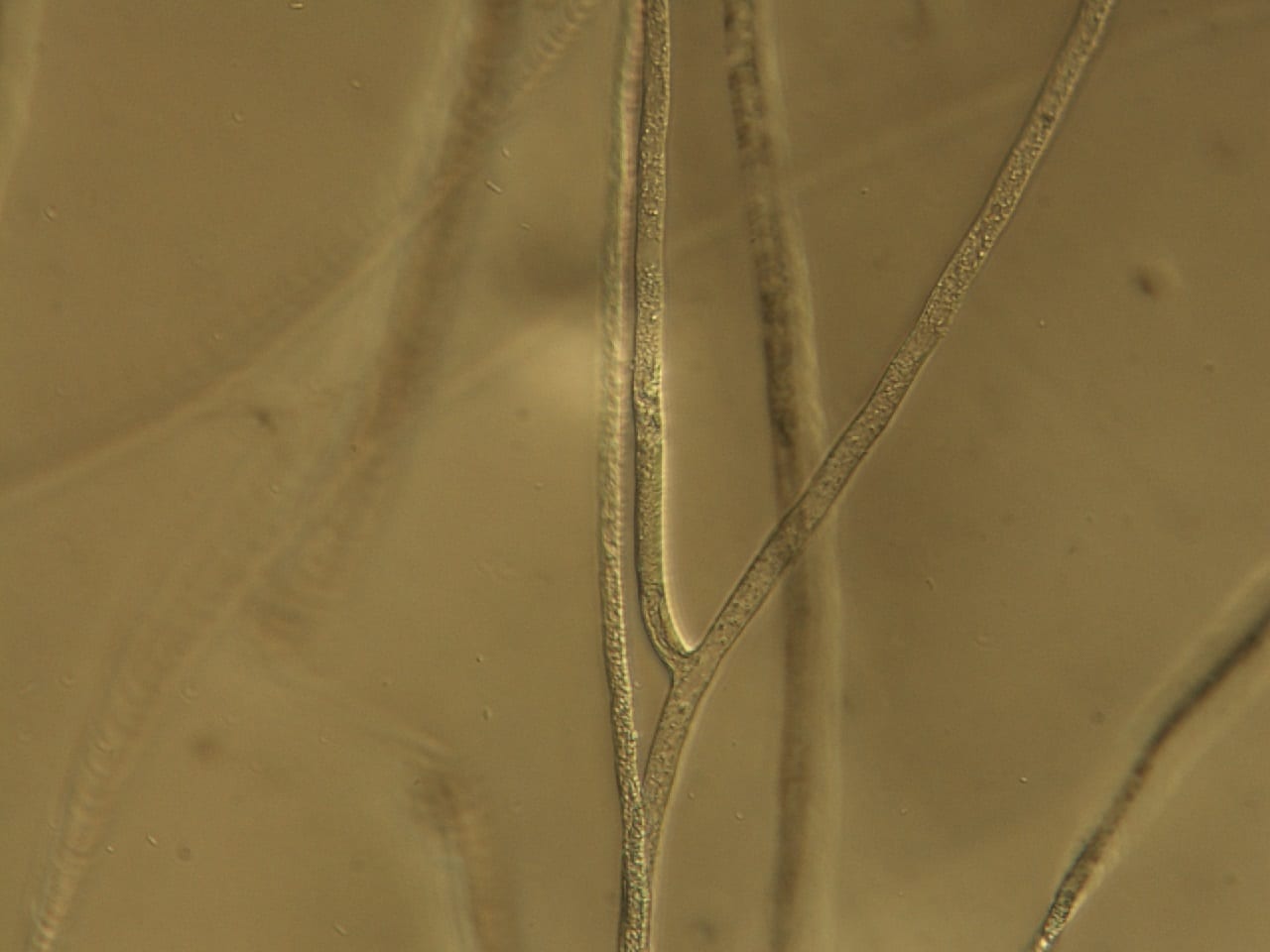 hyphae (fungal threads) with no crosswalls
