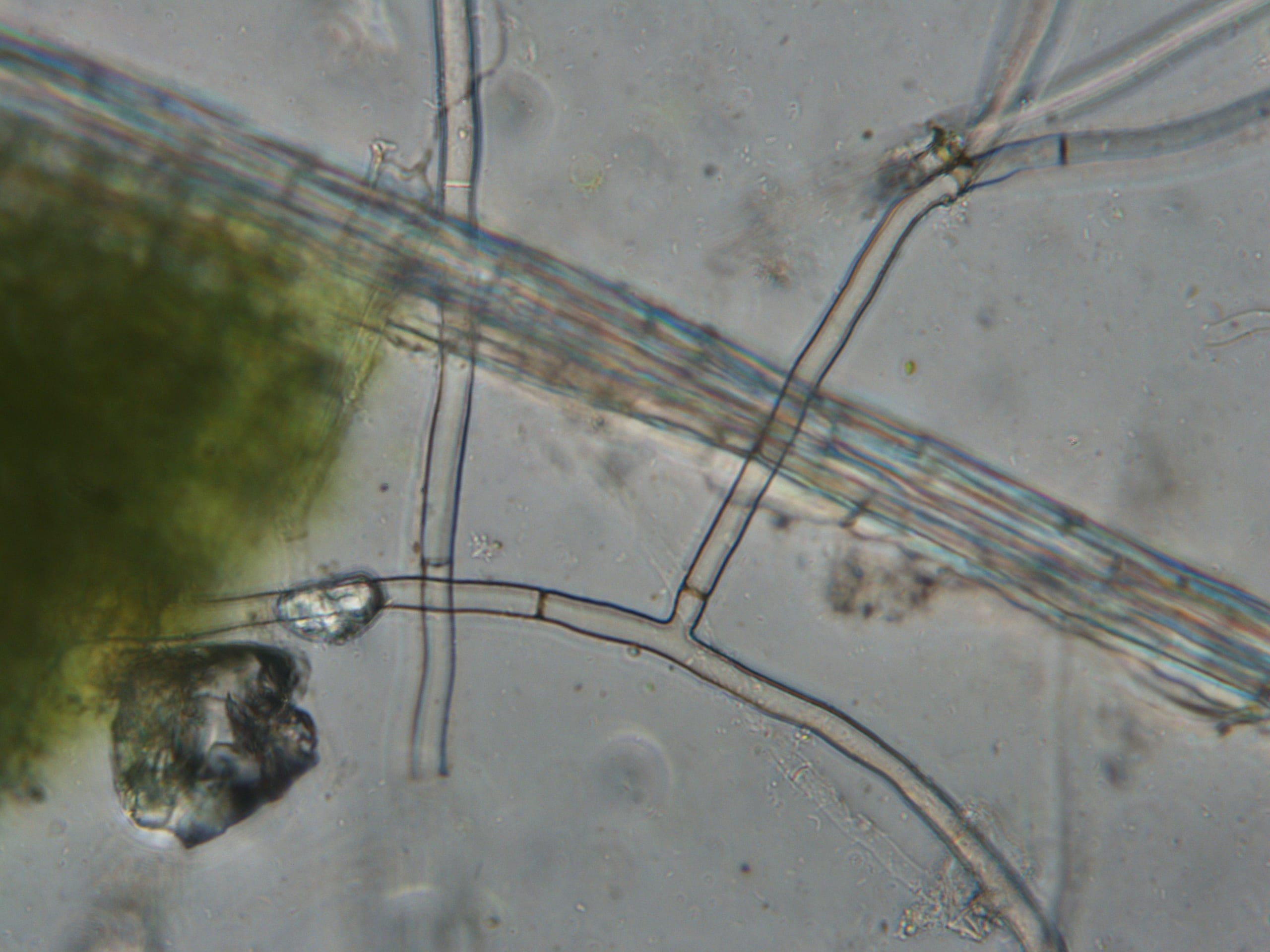 brown patch fungus produces distinctive cross-walls in the hyphae