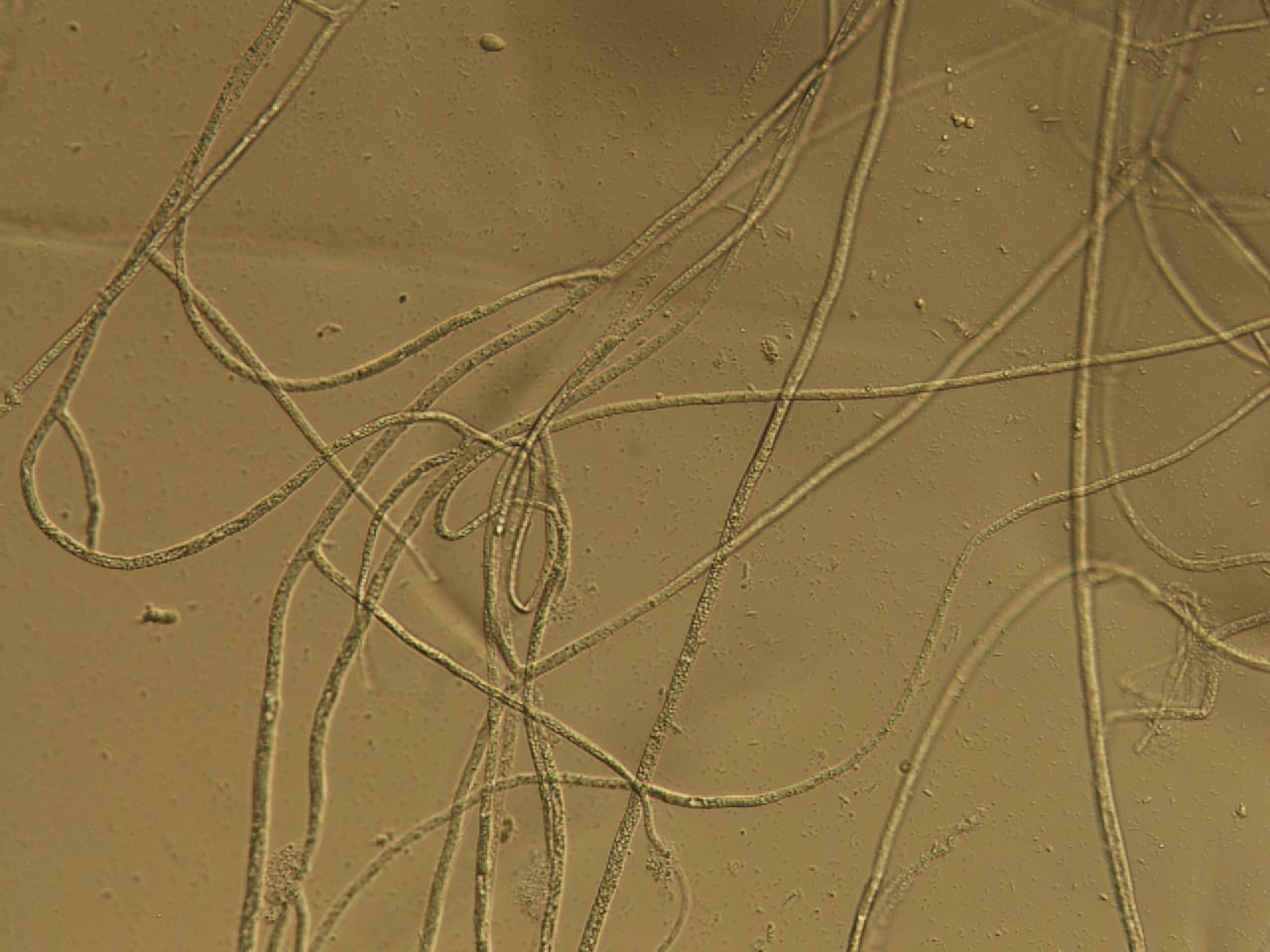 hyphae (fungal threads) with no crosswalls