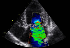 image of cardiac ultrasound