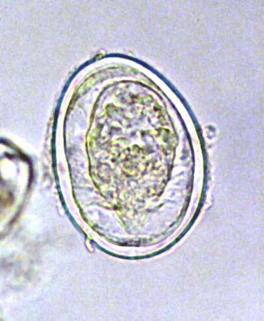 schistosoma japonicum