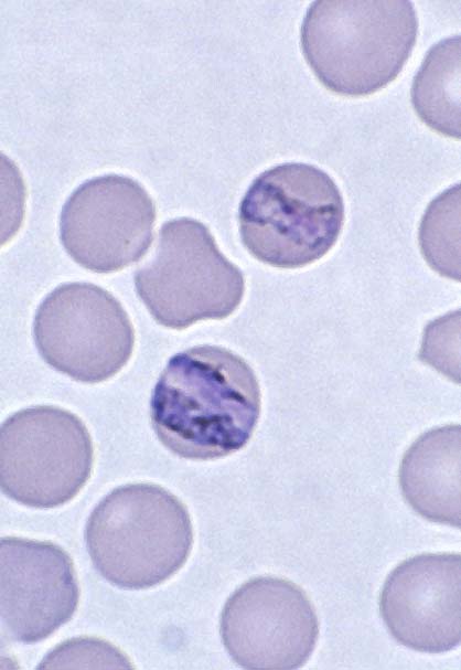 The Biology of Malaria Gametocytes | IntechOpen