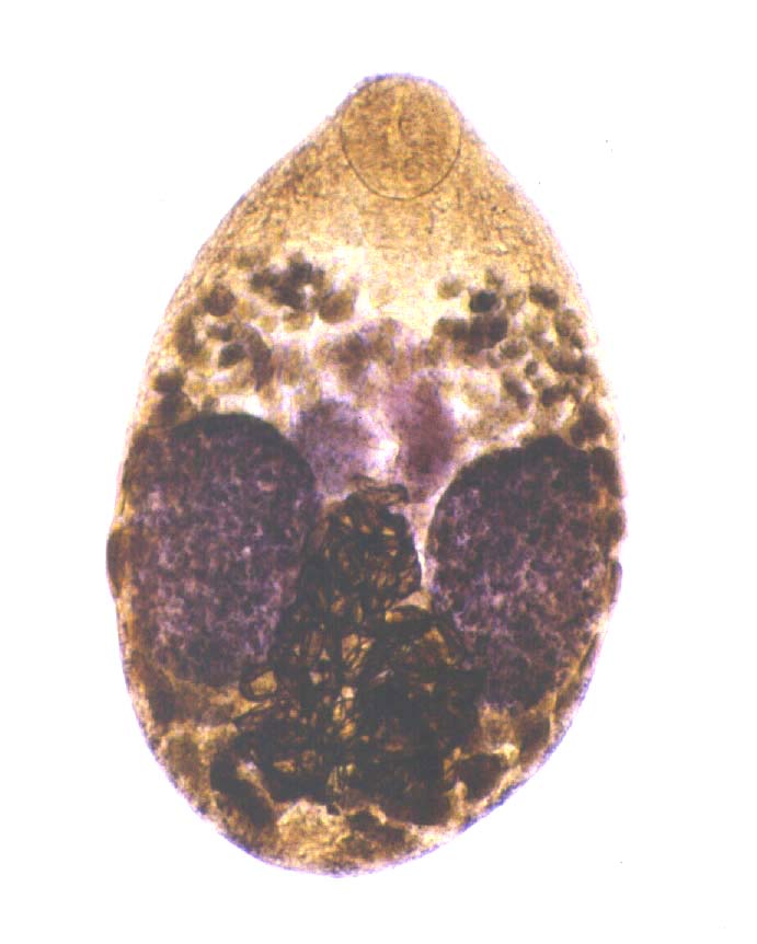 helminthoeca neorickettsia
