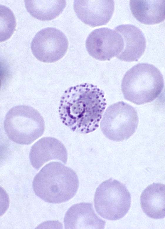 Malária plazmodium mikro és makrogametocitái