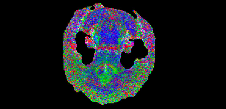 A new imaging technique shows a rat brain